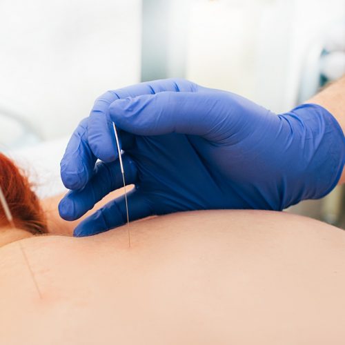 Groß (akkupunktur-1)