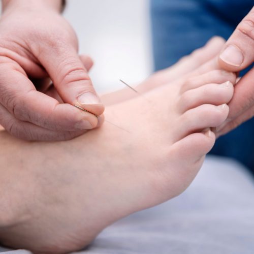 Groß (akkupunktur-2)