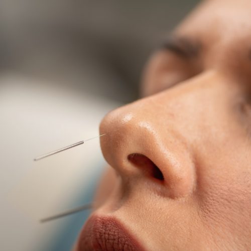 Groß (akkupunktur-yamamoto-2)